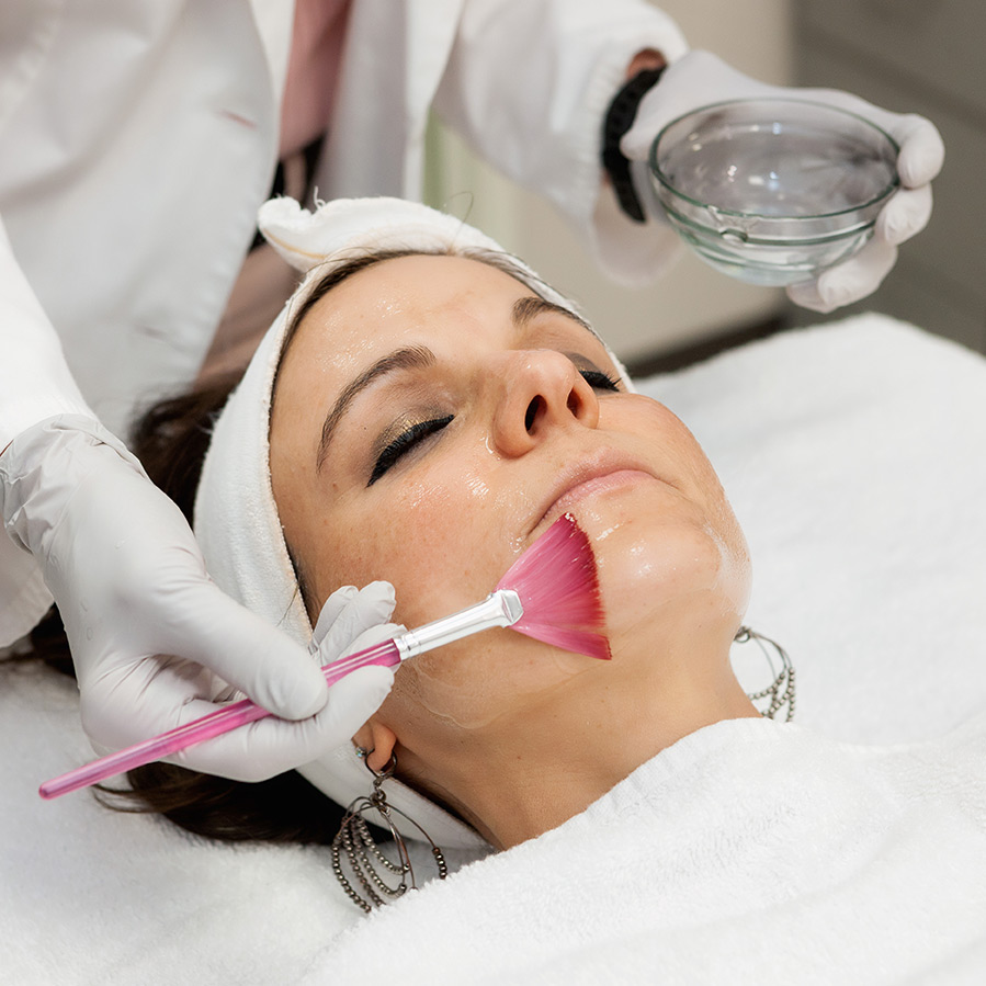 Acne Treatment Center | Medical Grade Chemical Peel