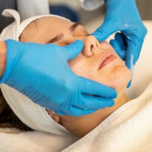 Acne Treatment Procedure